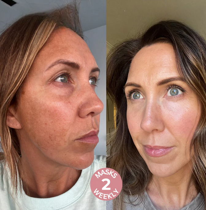 Glass Skin Mask, Before And After