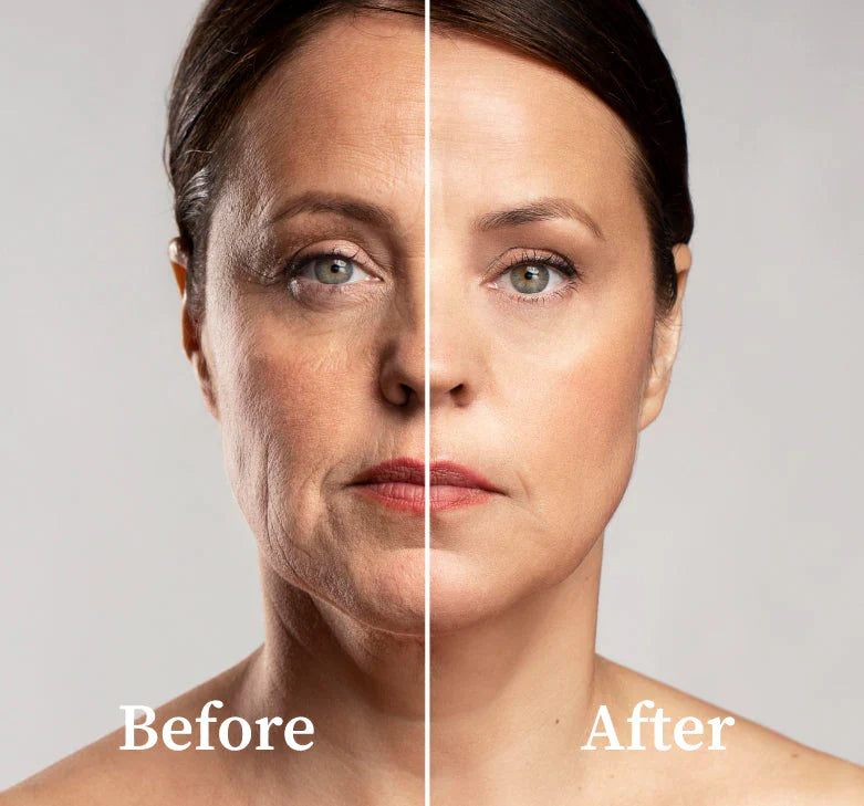 Collagen Face Mask, Before And After